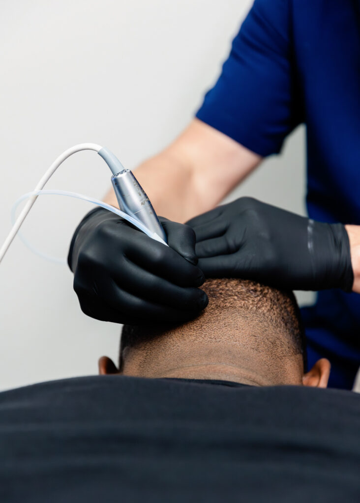 sculpt male plastic surgery 1 5x7