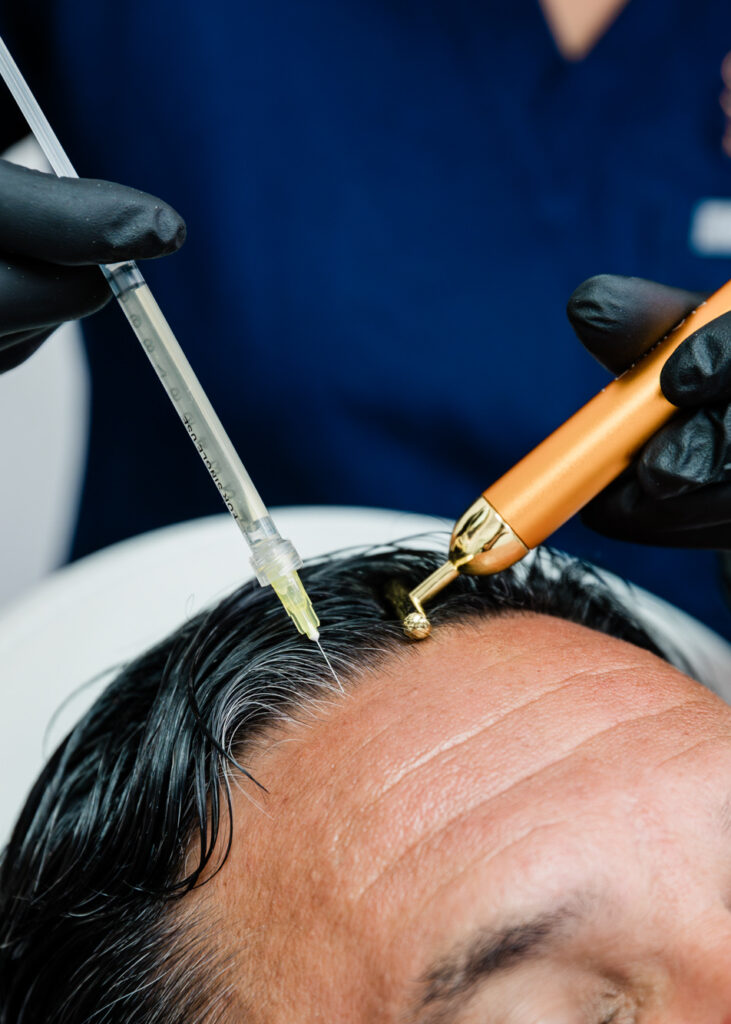 sculpt male plastic surgery non surgical hair restorati 5x7